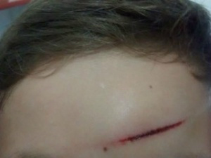 Uma das crianças teve ferimento na testa e outra na parte de trás da cabeça (Foto: JP News).