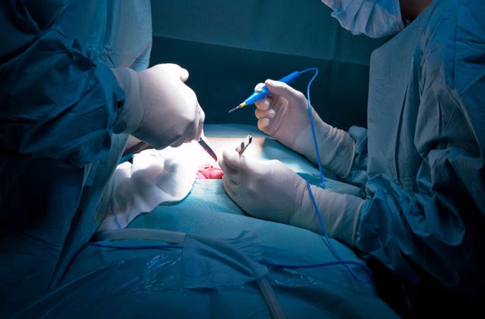 Hospital Universitário faz mutirão para reduzir fila por cirurgia vascular
