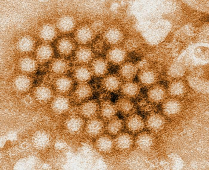 Vírus estomacal dá prejuízo de US$ 64 bi ao ano no mundo, diz estudo