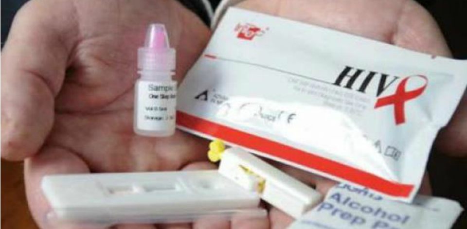 Diagnóstico do teste de HIV ocorre por meio de linhas de controle - Foto: Arquivo/Conselho Regional de Farmácia de Santa Catarina