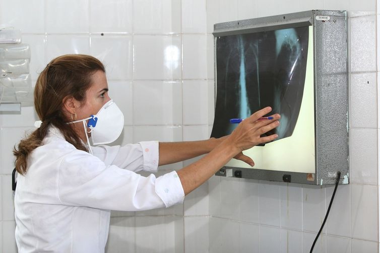 Exames ajudam a identificar a tuberculose  (Arquivo/Agecom Bahia)