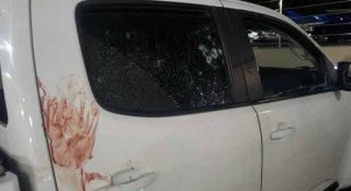 Filho de policial é executado a tiros de fuzil na Capital