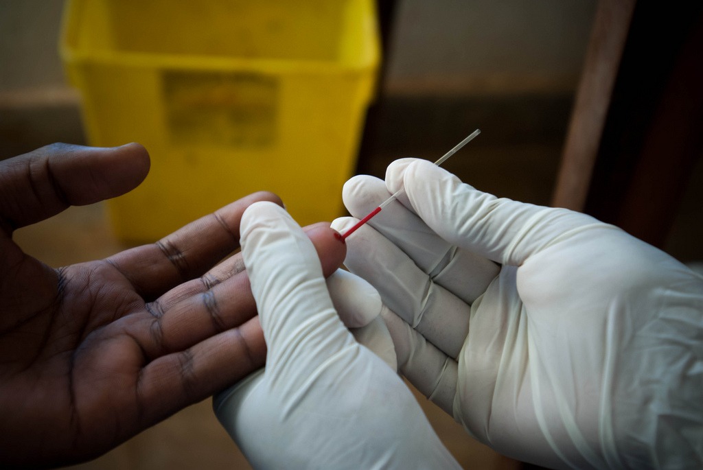Teste rápido de HIV. Foto: UNICEF/Sewunet